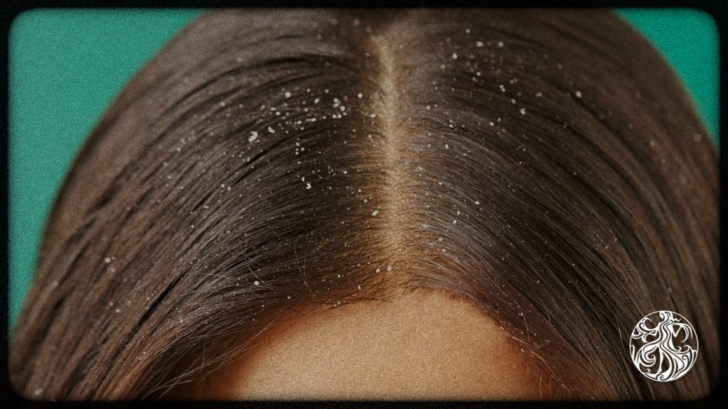 شامپو بیگ میر ضد شوره